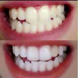 Toothpaste ap24