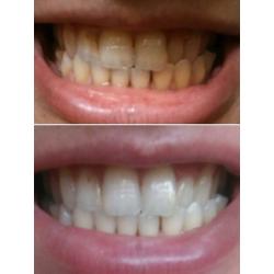 Toothpaste ap24