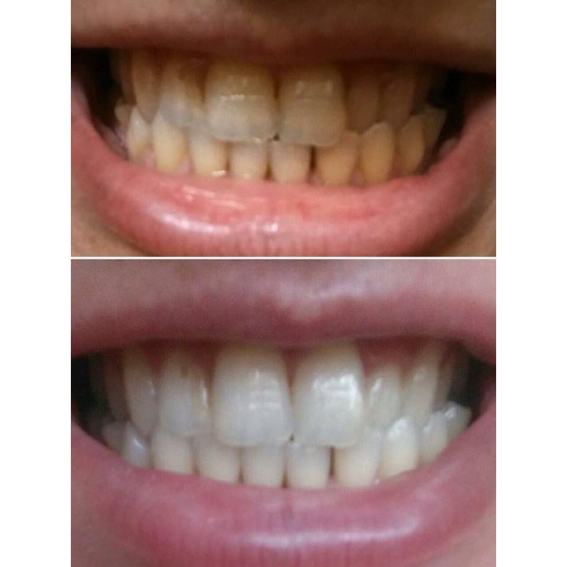 Toothpaste ap24