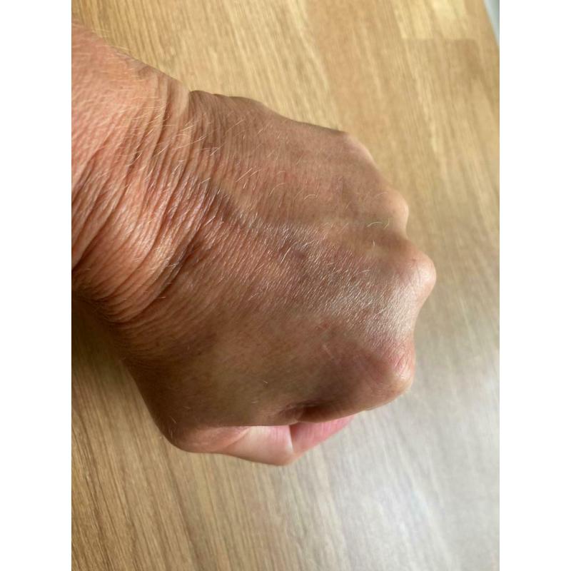 WRIST REHAB STRENGTH BUILD BALL was ?9